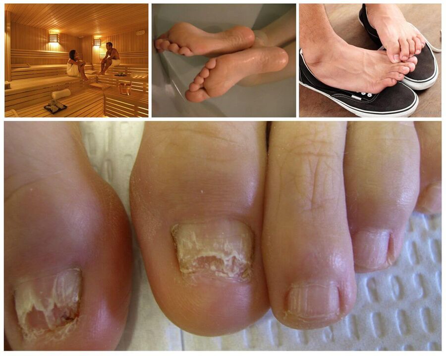 Les raisons de l'infection